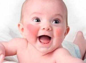 Как действовать при диатезе у ребенка?