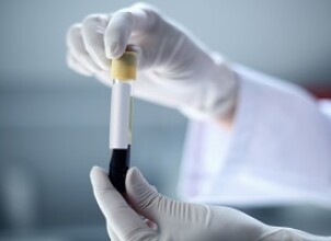 Причины понижения и повышения антитромбина 3 при беременности