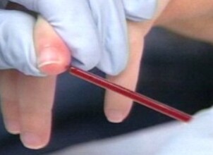 Норма нейтрофилов в крови у детей