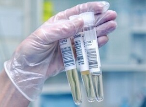 Бак посев мочи – обязательный и важный анализ для беременных