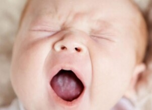 Из-за чего у грудничка появляется на языке белый налет