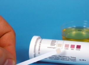 Почему появляется ацетон в анализе мочи?
