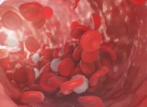 Кардиология в Германии с EMEX Medical GmbH: где точность медицины встречается с заботой о пациенте