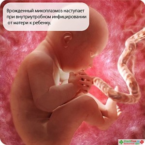 Микоплазмоз при беременности