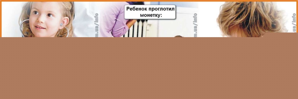 Ребенок проглотил монету