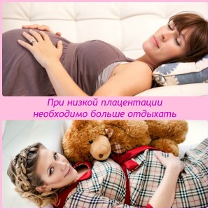 Низкая плацентация при беременности
