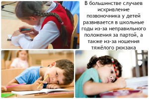 Нарушение осанки у детей школьного возраста