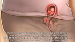 Частое мочеиспускание при беременности