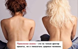Нарушение осанки у детей школьного возраста