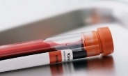как сдается тройной тест